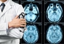 Alzheimer’s disease